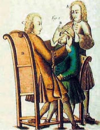 Figura 12. Operación de cataratas en la Edad Media.