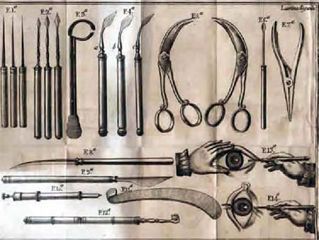 Figura 13. Instrumentos usados para la operación de cataratas.