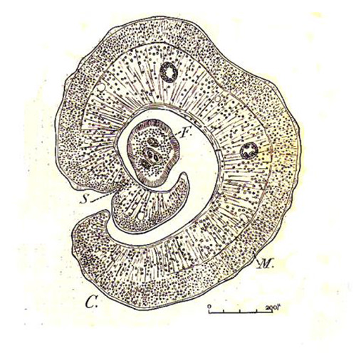 Fig 9. Granuloma bilharziano. Un verme macho envolviendo a una hembra en su canal ginecóforo. En la figura se compara la preparación histológica con una lámina de Brumpt (6)