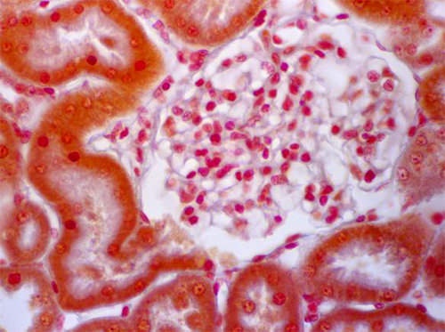 Fig 12. Esta figura confirma la identificación del segmento 1 de los túbulos proximales ya que se muestra uno de ellos emergiendo del polo urinario del corpúsculo renal. Se observa la transición abrupta de la hoja parietal de la cápsula de Bowman al epitelio cuboide del segmento 1 del túbulo proximal. Vasos peritubulares y ramillete capilar de los glomérulos renales están algo distendidos y libres de glóbulos sanguíneos debido a la perfusión intravascular del fijador. El espacio de Bowman, que se continúa con la luz del segmento1 del túbulo proximal correspondiente, se observa ligeramente distendido posiblemente por ultrafiltración de la solución fisiológica a través de las paredes de los capilares glomerulares. El conjuntivo se observa ligeramente edematizado.