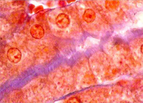 Fig 14. Segmento 3 de un túbulo proximal Las microvellosidades forman una empalizada paralela a la superficie convexa de las células parietales. Las microvellosidades observan muy regularmente dispuestas, como si estuvieran “peinadas”. Las células parietales se muestran cuboides y hasta cilíndricas, bien delimitadas unas de otras. El citoplasma es claro e irregularmente granular.