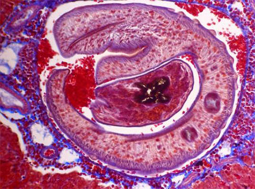 Fig 9. Granuloma bilharziano. Un verme macho envolviendo a una hembra en su canal ginecóforo. En la figura se compara la preparación histológica con una lámina de Brumpt (6)
