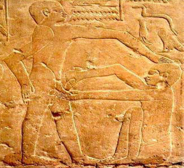 Fig. 13. Circuncisión de un adolescente en un grabado en la tumba de el médico Ankh-Mahor, en Saqqara.
