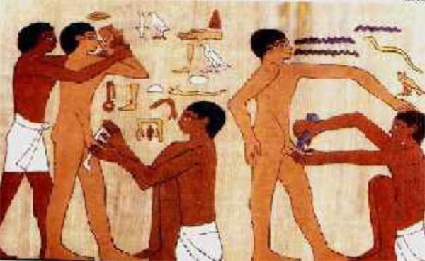 Fig. 13. Circuncisión de un adolescente en un grabado en la tumba de el médico Ankh-Mahor, en Saqqara.