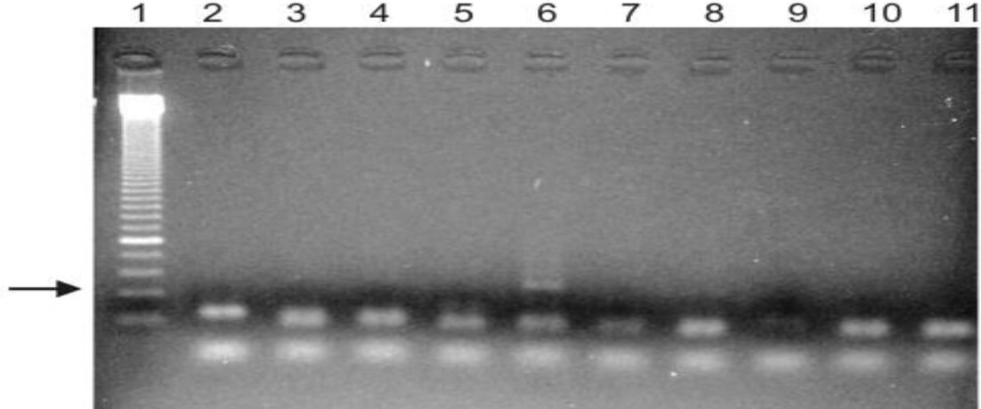 Fig 18. Amplificación de un fragmento de 134 pb del ADN antiguo de Plasmodium falciparum en momias egipcias. Carril 1, marcador molecular; Carriles 10 y 11, 2 controles negativos. Una (calle 6) de 8 muestras muestra un producto de amplificación positivo (flecha). La especificidad del producto fue verificada por secuenciación (335).