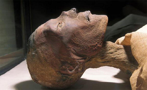 Fig. 19. Momia de Ramsés V (reinó en 1147-1143 a. C., Dinastía XX) Sala de las Momias Reales, Museo de El Cairo.