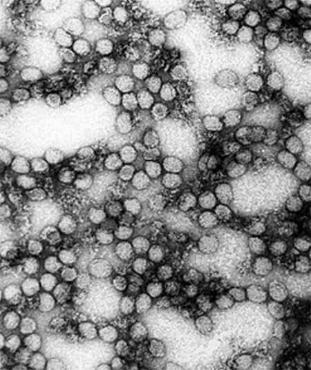 Figura 8. Virus de la fiebre amarilla