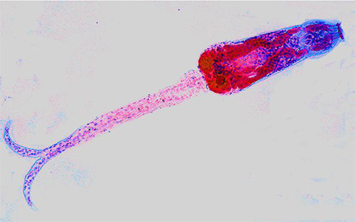 Fig 5. Cercaria de Schistosoma mansoni. Preparación del autor.
