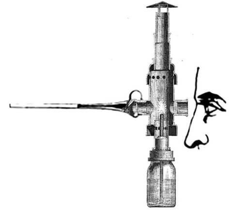 Figura 2: El endoscopio de Desormeaux se considera sucesor del conductor de Bozzini. Desormeaux utilizó una lámpara de alcohol como fuente de luz, en 1853, reflejada por un espejo cóncavo, fue utilizado como cistoscopio. Con este instrumento se pudo ver el interior de la uretra y la vejiga, así como también las cavidades nasales. Poco después, Desormeaux mejoró la fuente de luz mediante una lámpara transparente que utilizaba una mezcla de gasógeno y alcohol y generaba una luz más brillante.