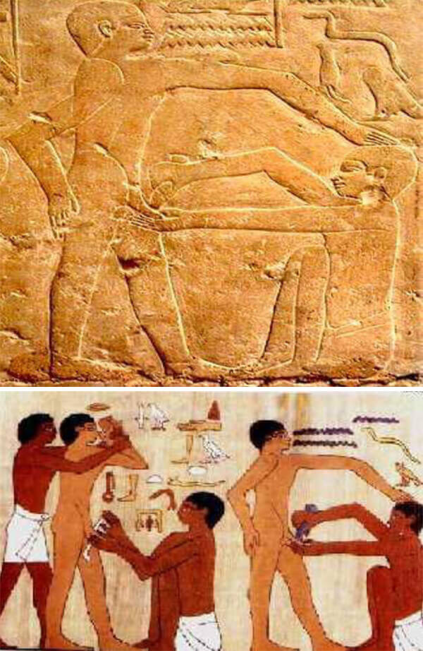 Fig. 13. Circuncisión de un adolescente en un grabado en la tumba de el médico Ankh-Mahor, en Saqqara.