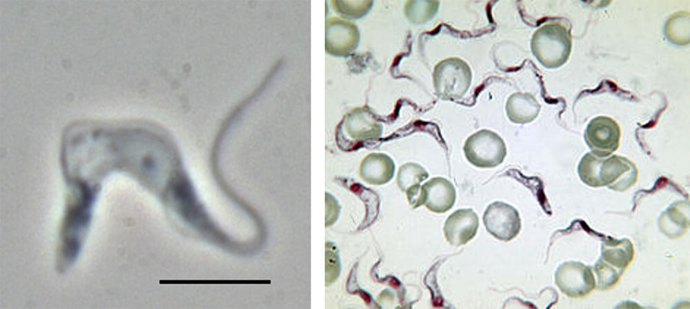 Figuras 5 y 6. A la izquierda, Tripanosoma brucei brucei, forma sanguínea, imagen por contraste de fase, barra: 10 µm. Reino: Protista; Filo: Euglenozoa; Clase: Kinetoplastea; Orden: Trypanosomatida; Familia: Trypanosomatidae; Género: Trypanosoma; Especie: T. brucei. A la derecha, T brucei entre glóbulos sanguíneos.