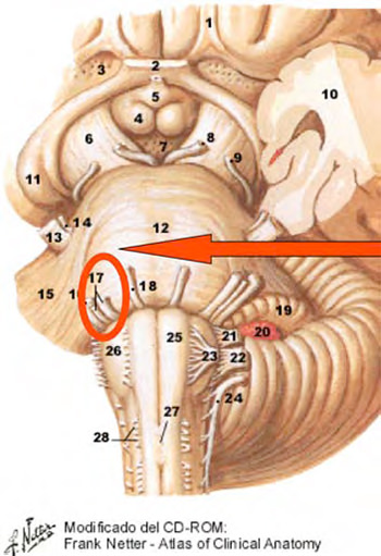 Figura 4. Raíces del Facial (VII).